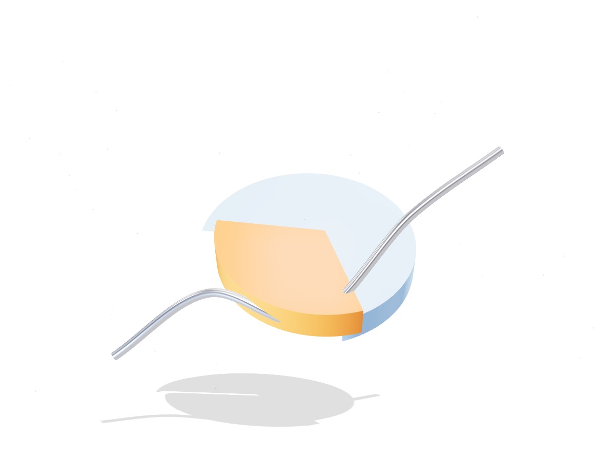 Case study: analytics